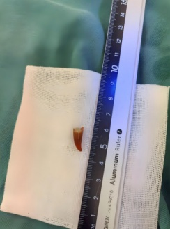 【31省区市新增本土确诊55例/31省区市新增53例本土确诊】